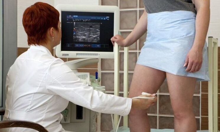 Coagulación con láser para el tratamiento de las venas varicosas
