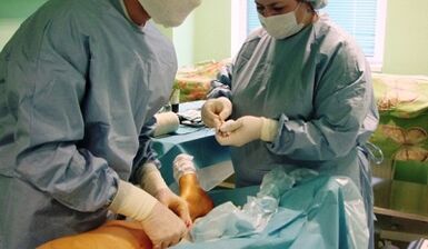 Operación para venas varicosas