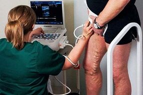 Opciones de diagnóstico para venas varicosas en las piernas