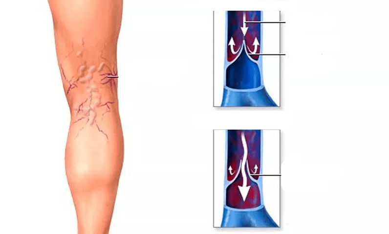 movimiento sanguíneo