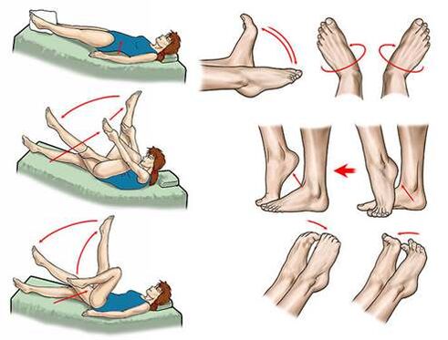 métodos para tratar las venas varicosas de la pelvis