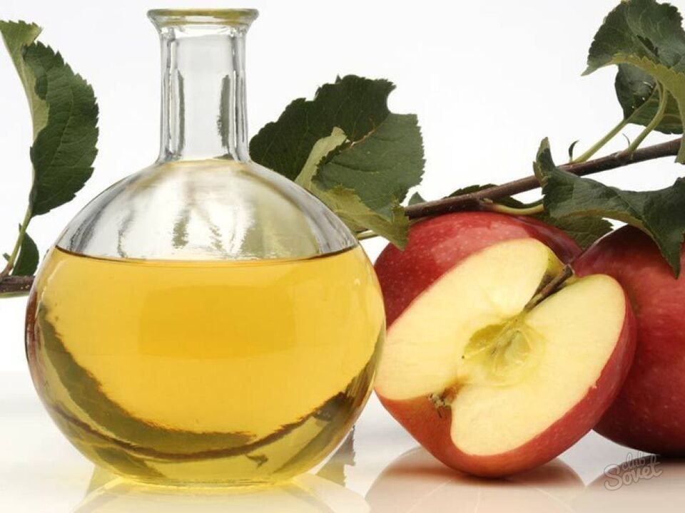 vinagre de manzana para las varices